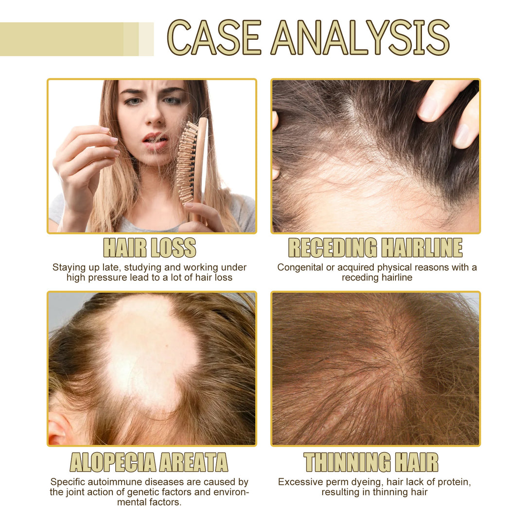 Various hair loss conditions pictured for analysis